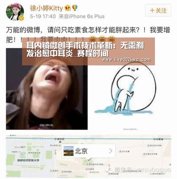 耳内镜微创手术技术革新:无需剃发治愈中耳炎_赛程时间(图1) 球队资料